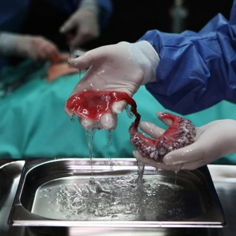 We're partnering with the Annual Meeting of New Champions to explore how we achieve inclusive growth in the Fourth Industrial Revolution