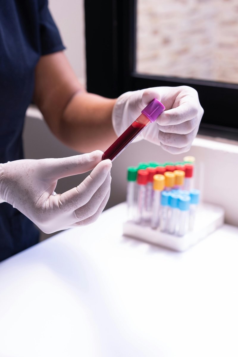 functional medicine testing bloodwork