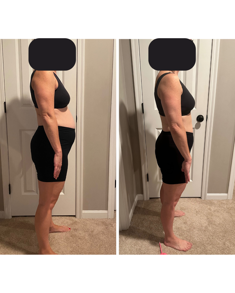 Kimberly transformation