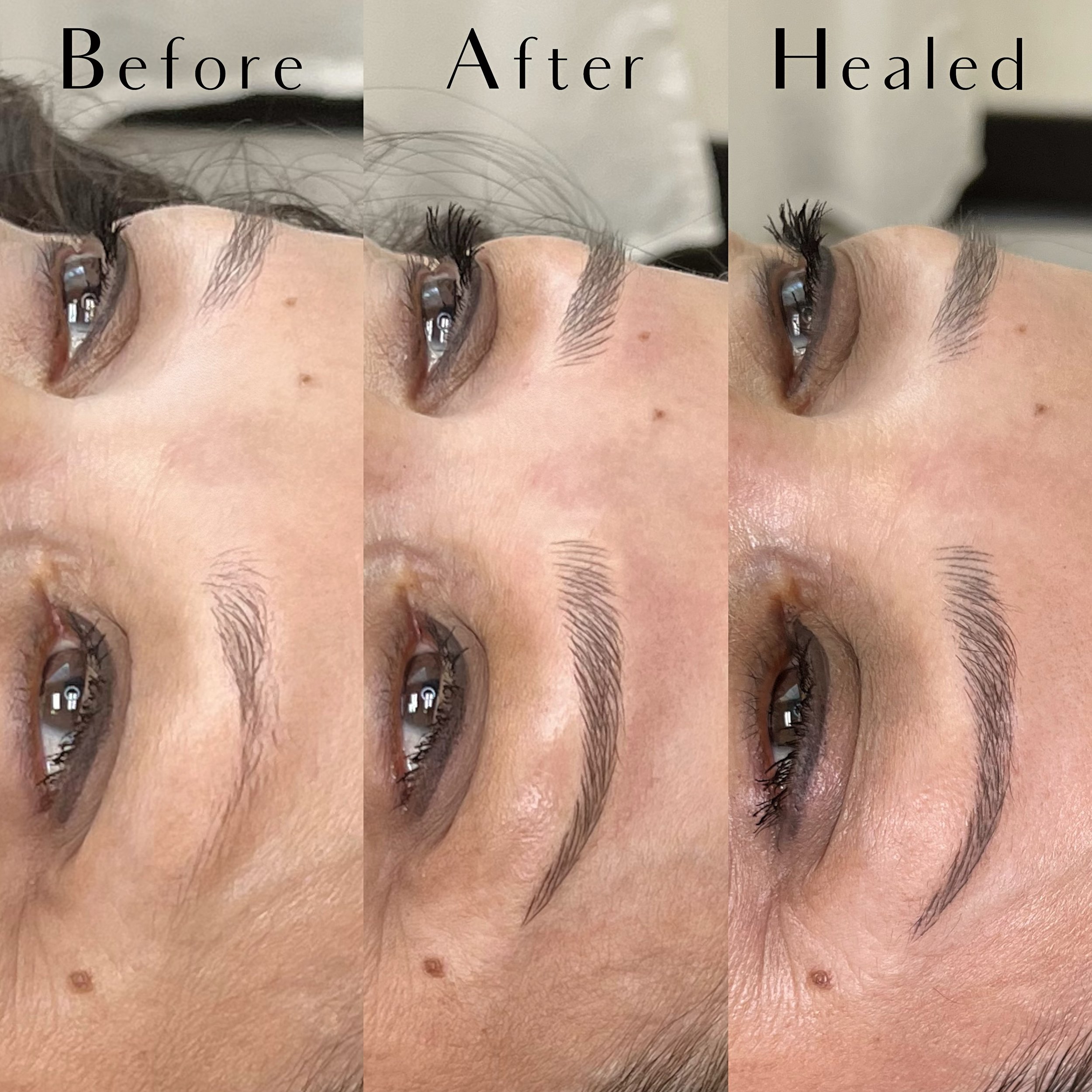 How do we achieve such fabulous healed microblading? By being the right candidate!

Being the ideal candidate means you have smooth skin, small pores, normal/dry skin, medium/fine hair texture AND density. Hair that is sparsely spread over the whole 