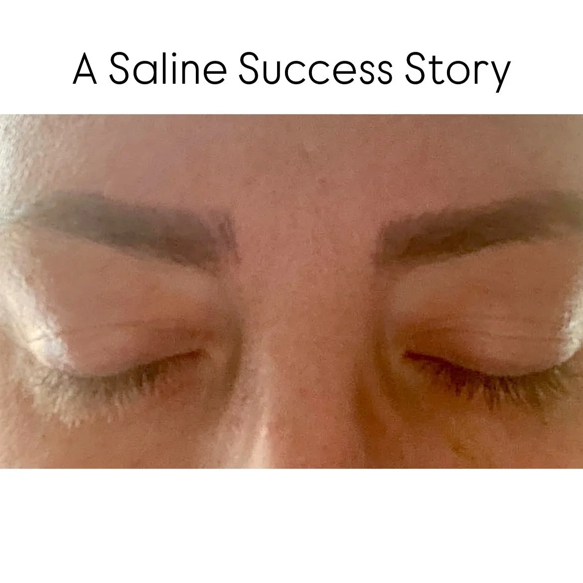 Let&rsquo;s take a walk down my clients brow journey!

1- (2021) Image that she sent me asking what could be done to help her brows. She had them done elsewhere and wasn&rsquo;t happy with the results. The other artist had microbalded her way above w