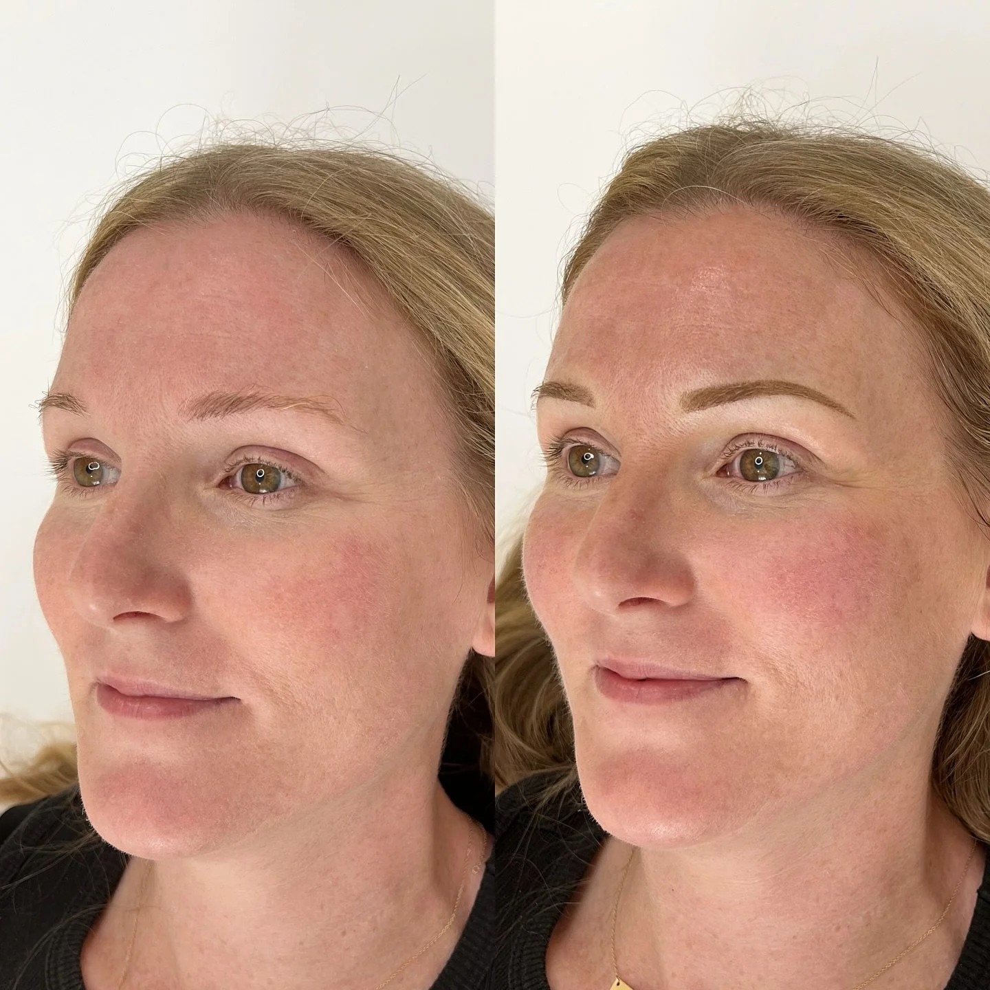 Never underestimate the power of brows in all sizes! Even a set of thin brows can frame the eyes and bring life to your face✨
&bull;
&bull;
&bull;
&bull;
#sacramentobrows #folsombrows #rosevillebrows #renobrows #modestobrows #chicobrows #stocktonbrow