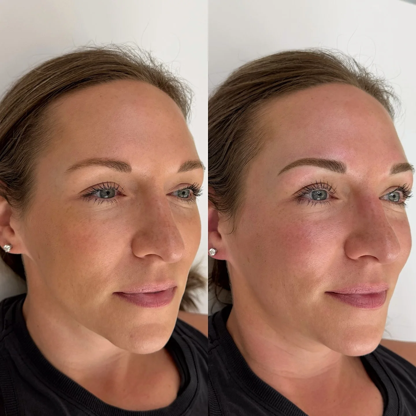 Wide set brows? This is a very common brow concern and most of this time we can only bring them 1-2mm closer. 
Why can&rsquo;t we bring them to their &lsquo;perfect&rsquo; spot? 

Welcome to class. 
We cannot give them perfection because when we&rsqu