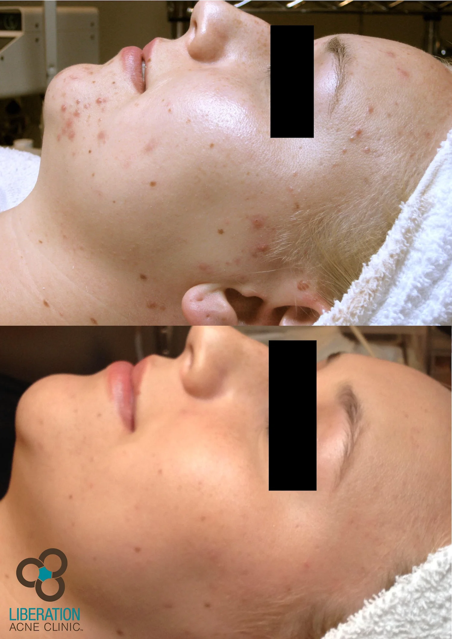  Lorem ipsum dolor amet tacos blue bottle shoreditch subway tile, twee quinoa chambray dreamcatcher XOXO chicharrones activated charcoal iceland fanny pack. Bespoke whatever banh mi artisan, 3 wolf moon chartreuse humblebrag kale chips post-ironic ac