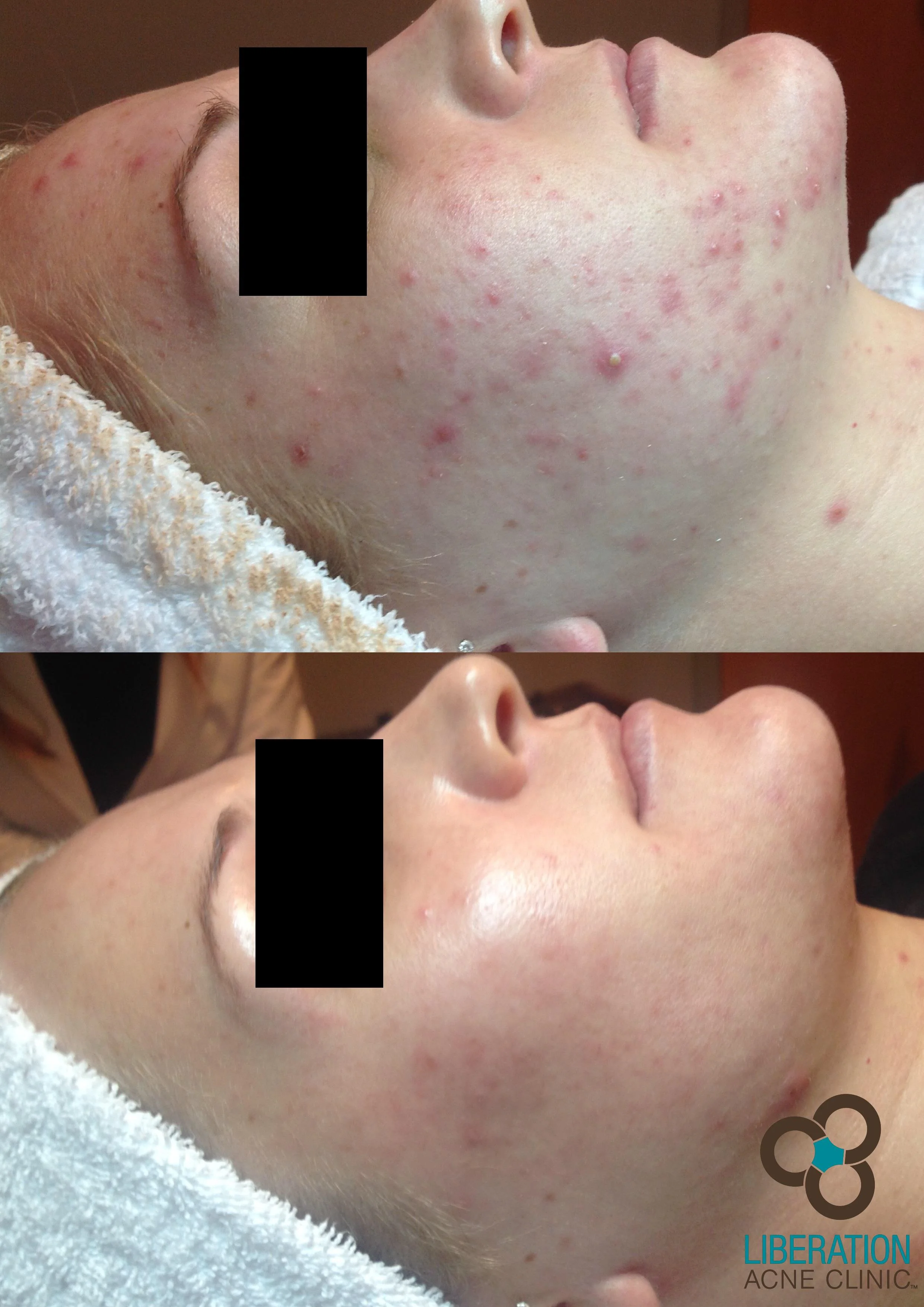  Letterpress microdosing +1 artisan, fanny pack pinterest pork belly squid bitters messenger bag man braid raclette thundercats kickstarter subway tile. Normcore meggings everyday carry freegan migas DIY four dollar toast ethical succulents polaroid 