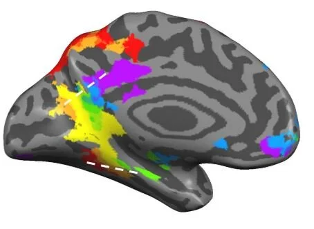 Processing of different spatial scales in the human brain
