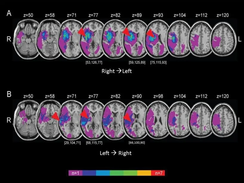 Nature and nurture effects on the spatiality of the mental time line
