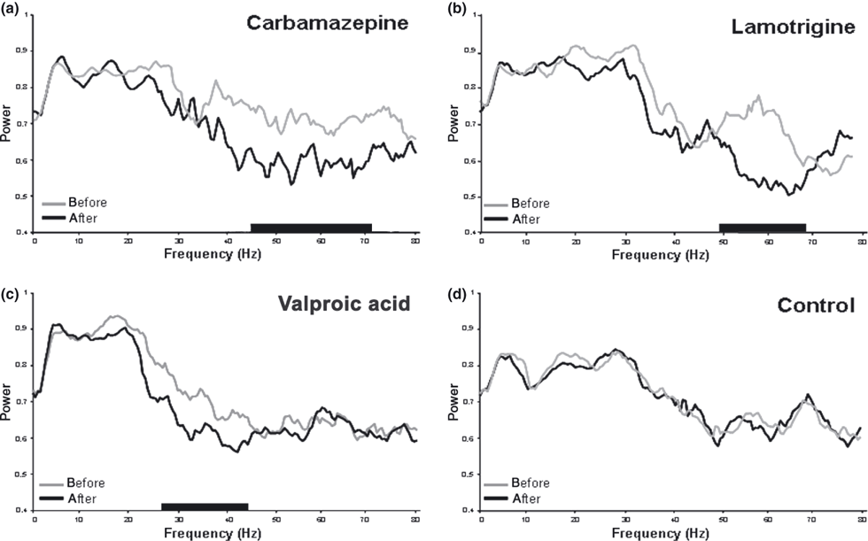 Antiepileptic drugs modify power of high EEG frequencies and their neural generators