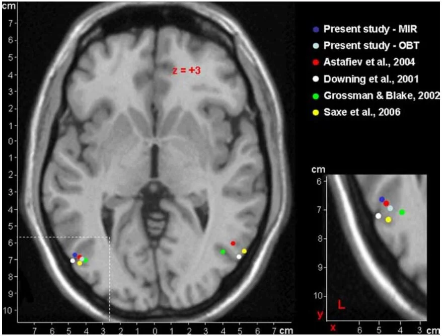 Neural Basis of Embodiment: Distinct Contributions of Temporoparietal Junction and Extrastriate Body Area