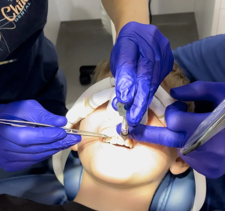 How to Reposition a Luxated (Displaced) Permanent Tooth — Kids Dental Tips