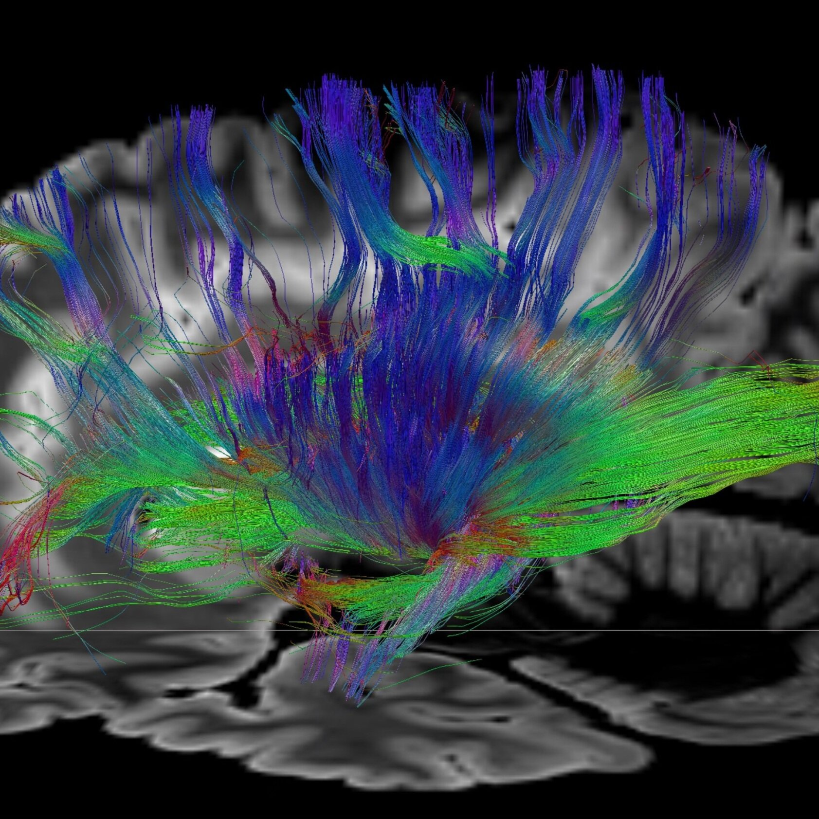 Mapping the Connectivity of Consciousness