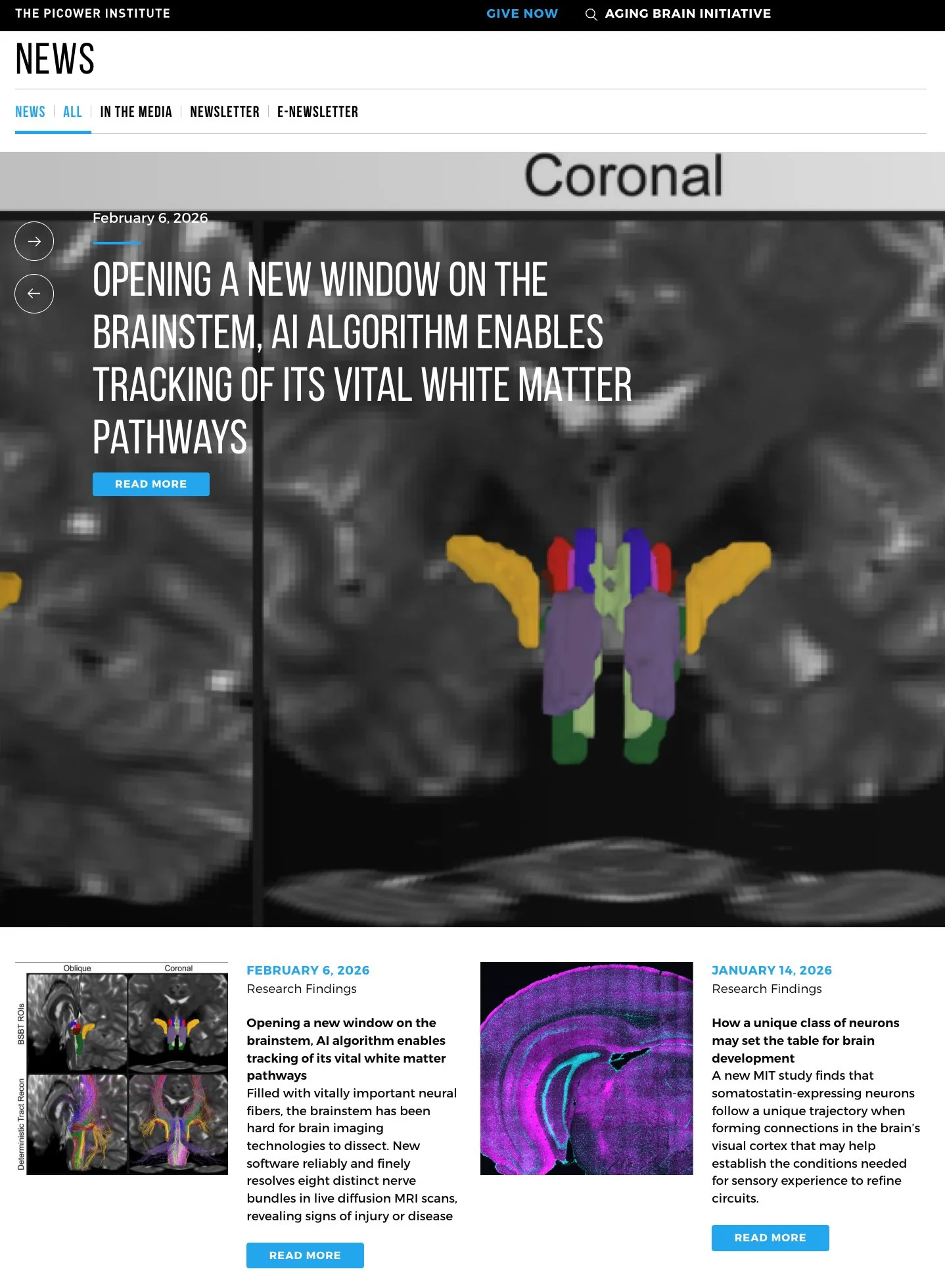 NICC Graduate Student Mark Olchanyi develops new technique to map the human brainstem connectivity