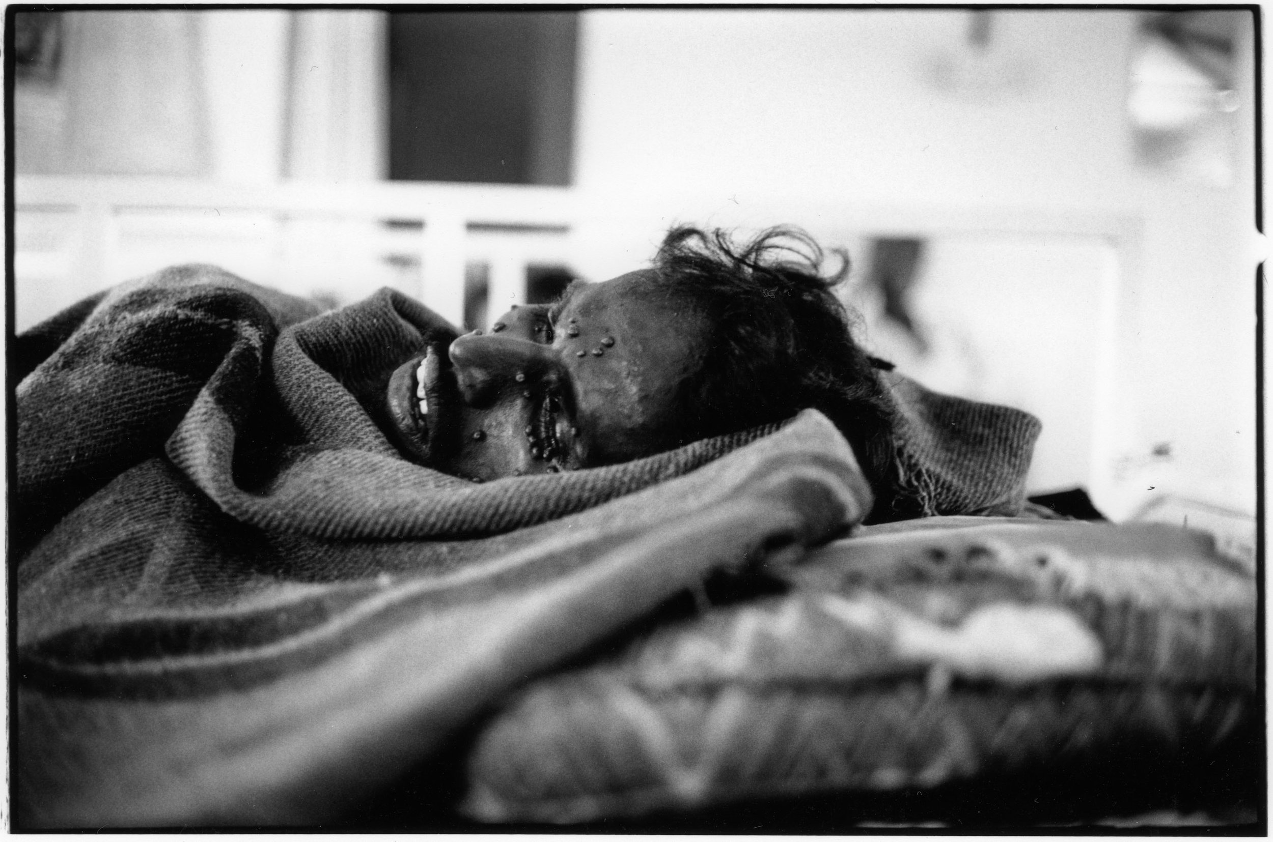 02_freelance photographer_Srinivas Kuruganti_New Delhi_HIV AIDS India.jpg