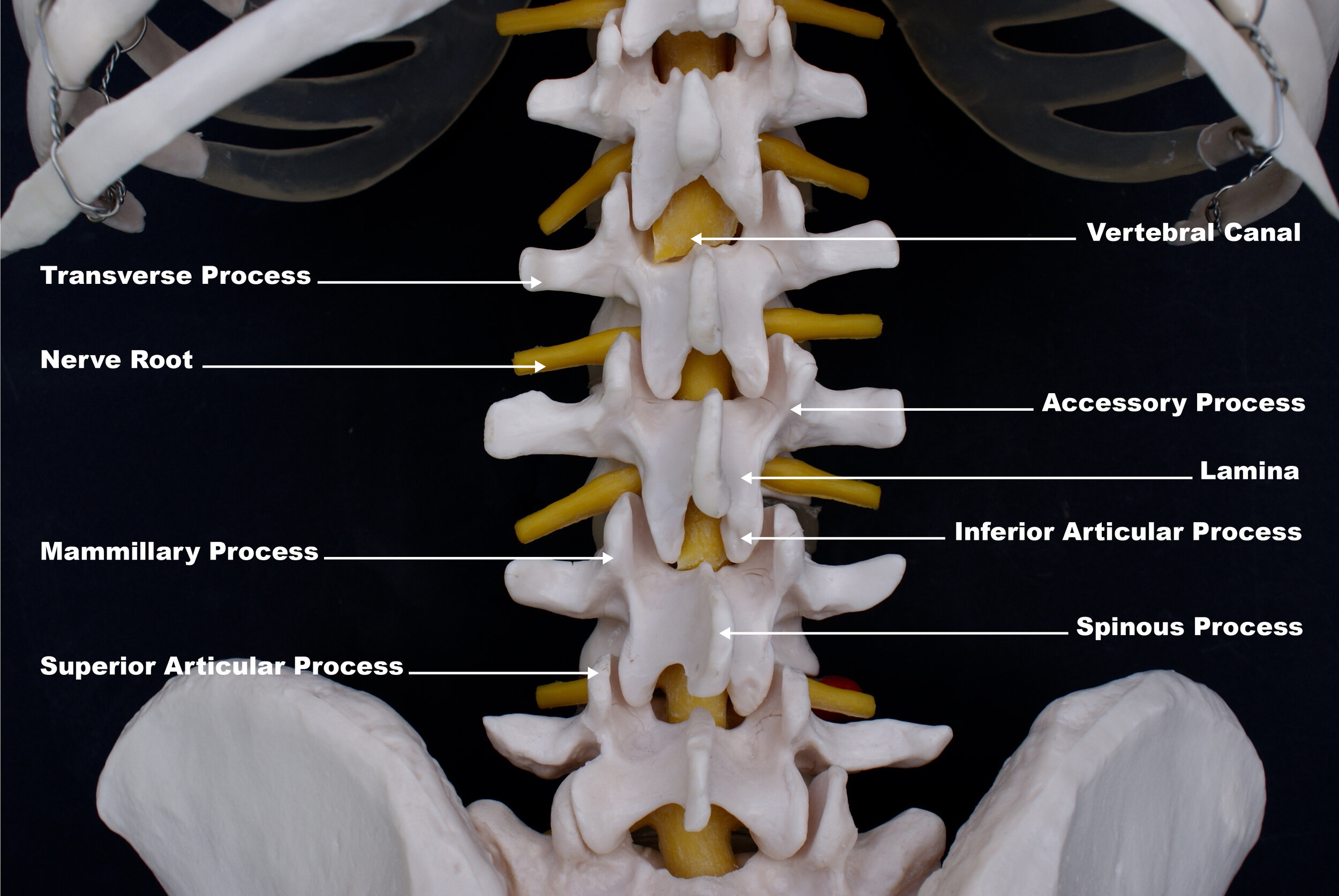 does dry needling work for back pain