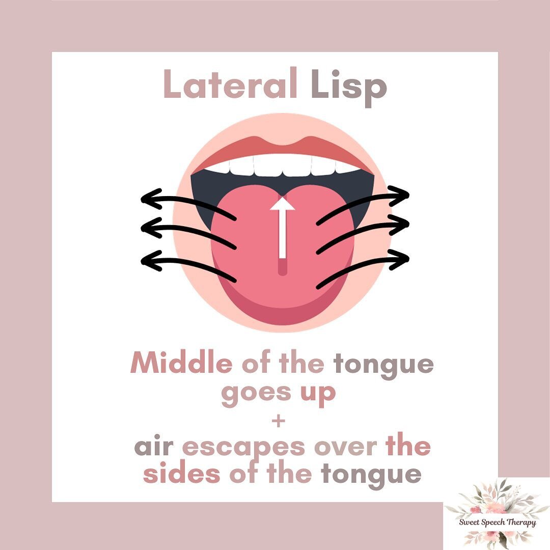 👄 A lateral lisp is an articulation error that can affect S, Z, SH, CH, J, and ZH (e.g. measure) sounds.

👄 Typically, when we produce these sounds, the sides of our tongue go up to make contact with the inside of our top back molars. This creates 