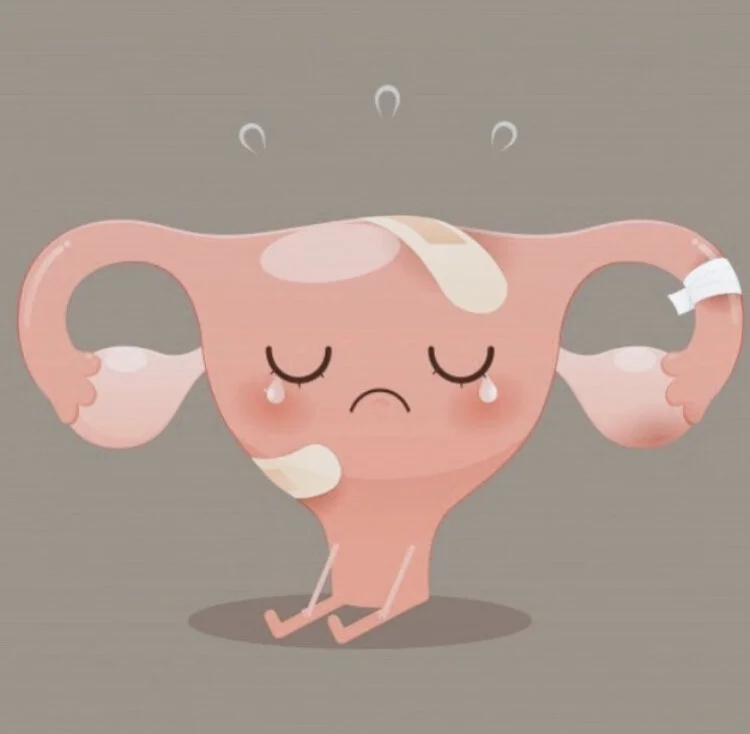 My Nerves and I - Neuropelveology a New Way to Treat Pelvic Pain