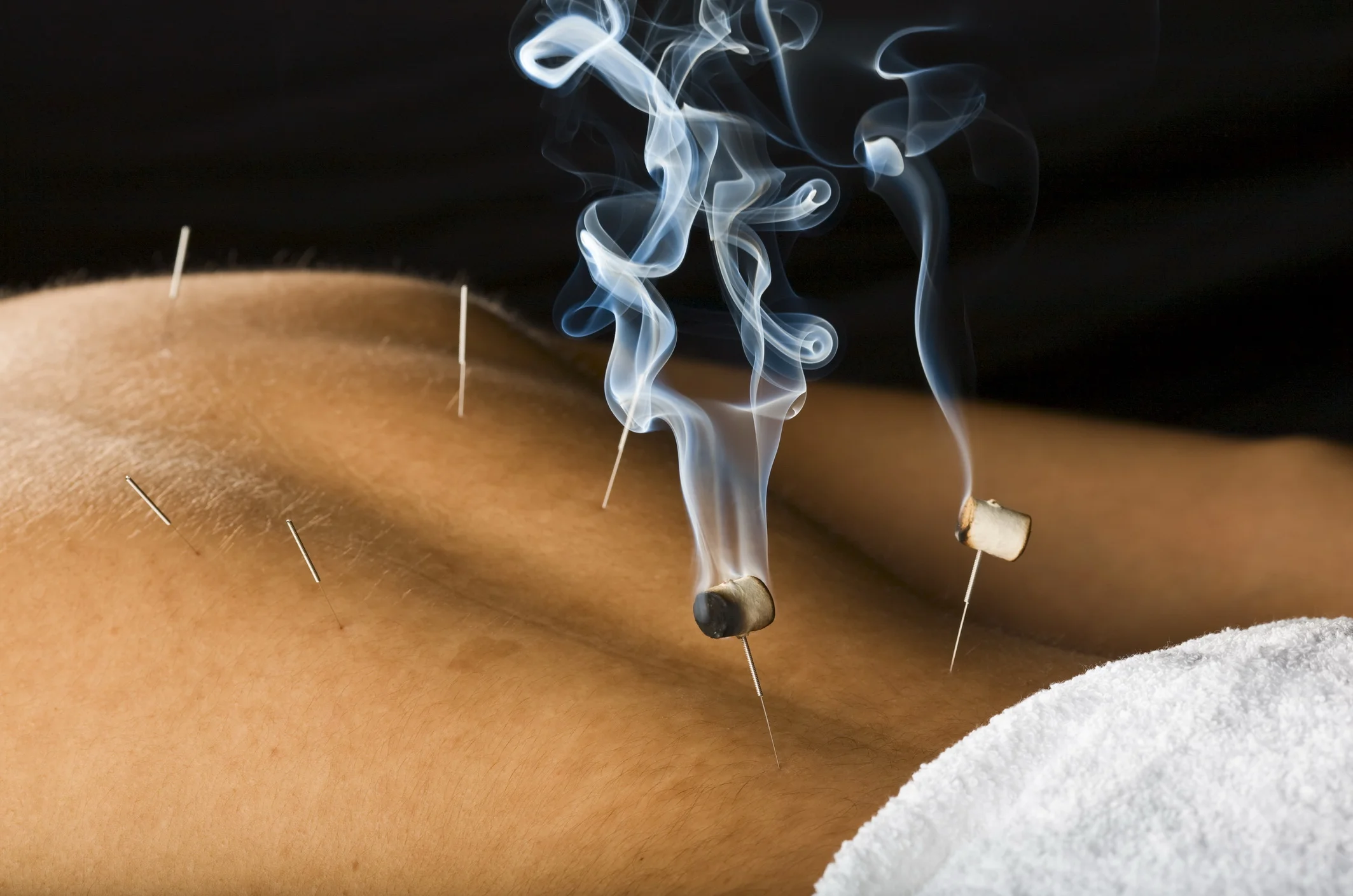 Moxibustion to warm and nourish the Kidneys.
