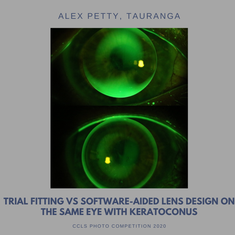 CCLS - Trial Fitting-2.png