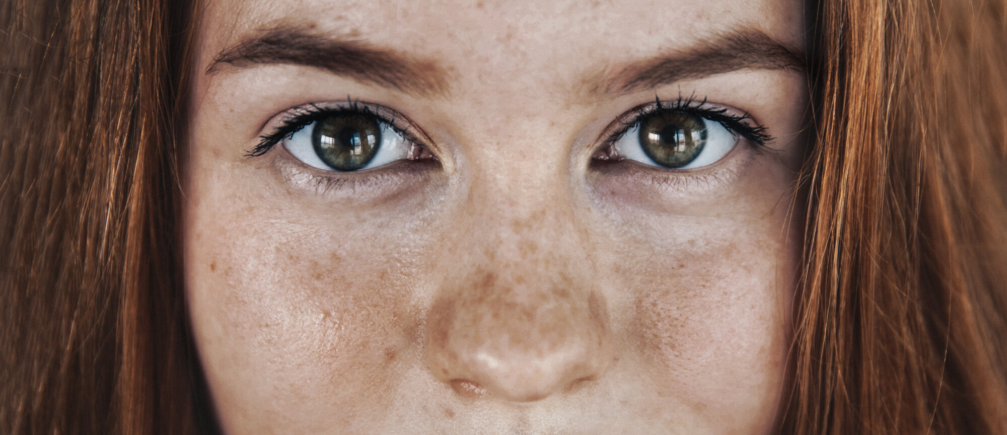 Face Dark Spots: 8 Questions About Hyperpigmentation