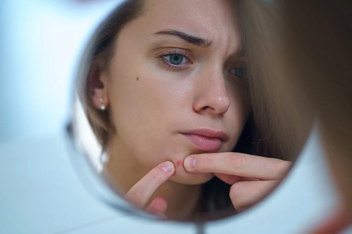 Your teen struggling with pimples? Clarity and Acnevelle Plus stops them in their tracks 