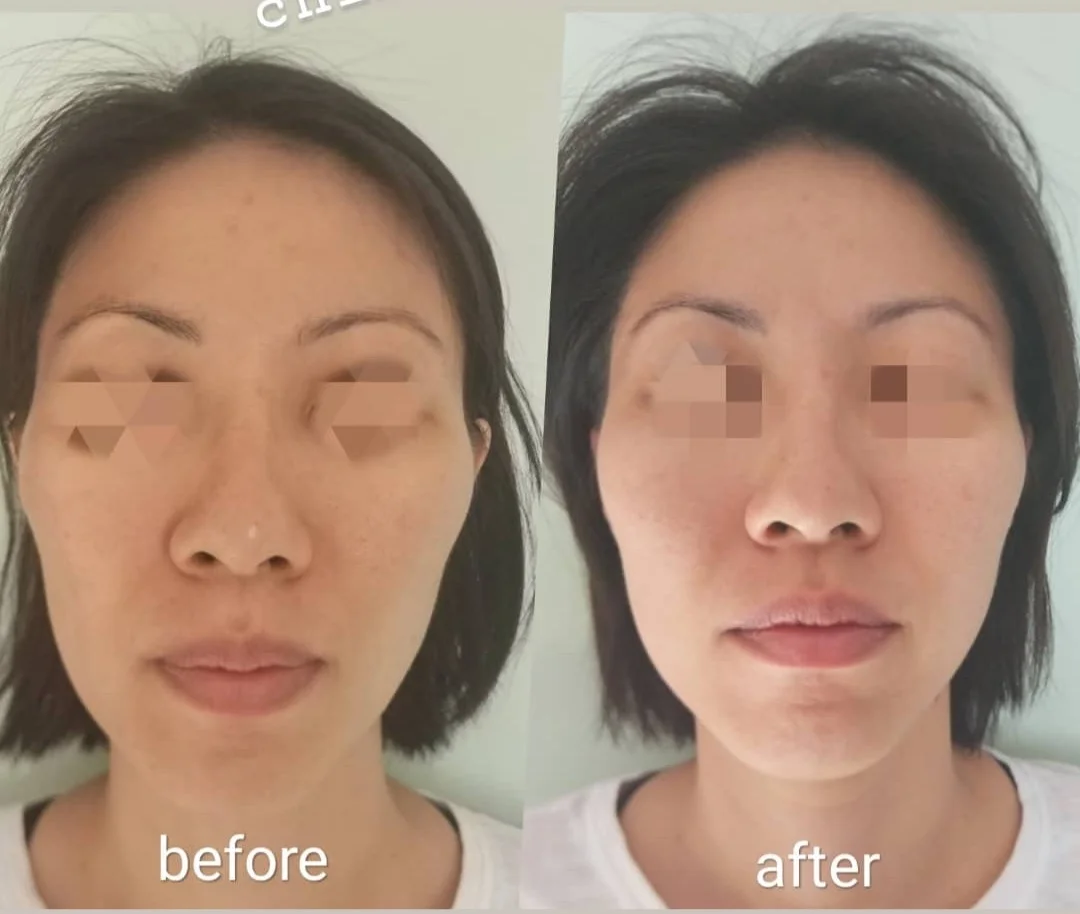 TCM Fengshui Facial Sculpting