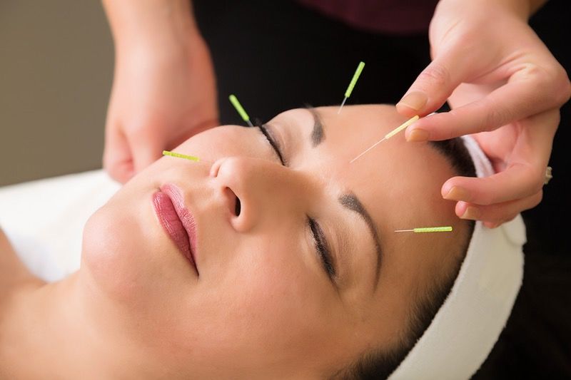 Facial Acupuncture – How to differentiate the Real Deal from the Fakers?