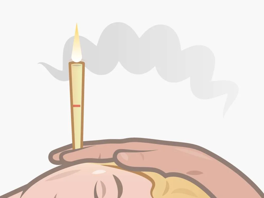 content-1480690200-ear-candling.jpg