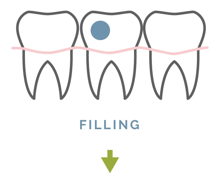 filling-01.jpg
