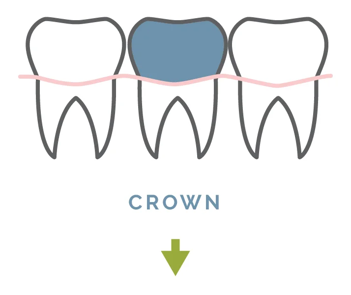 crown-01.jpg