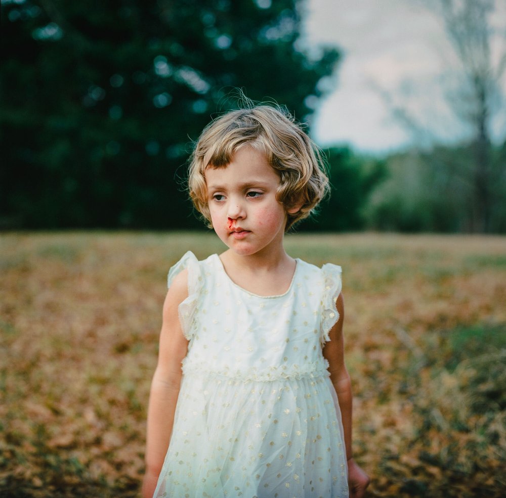 Bloody Nose Birthday