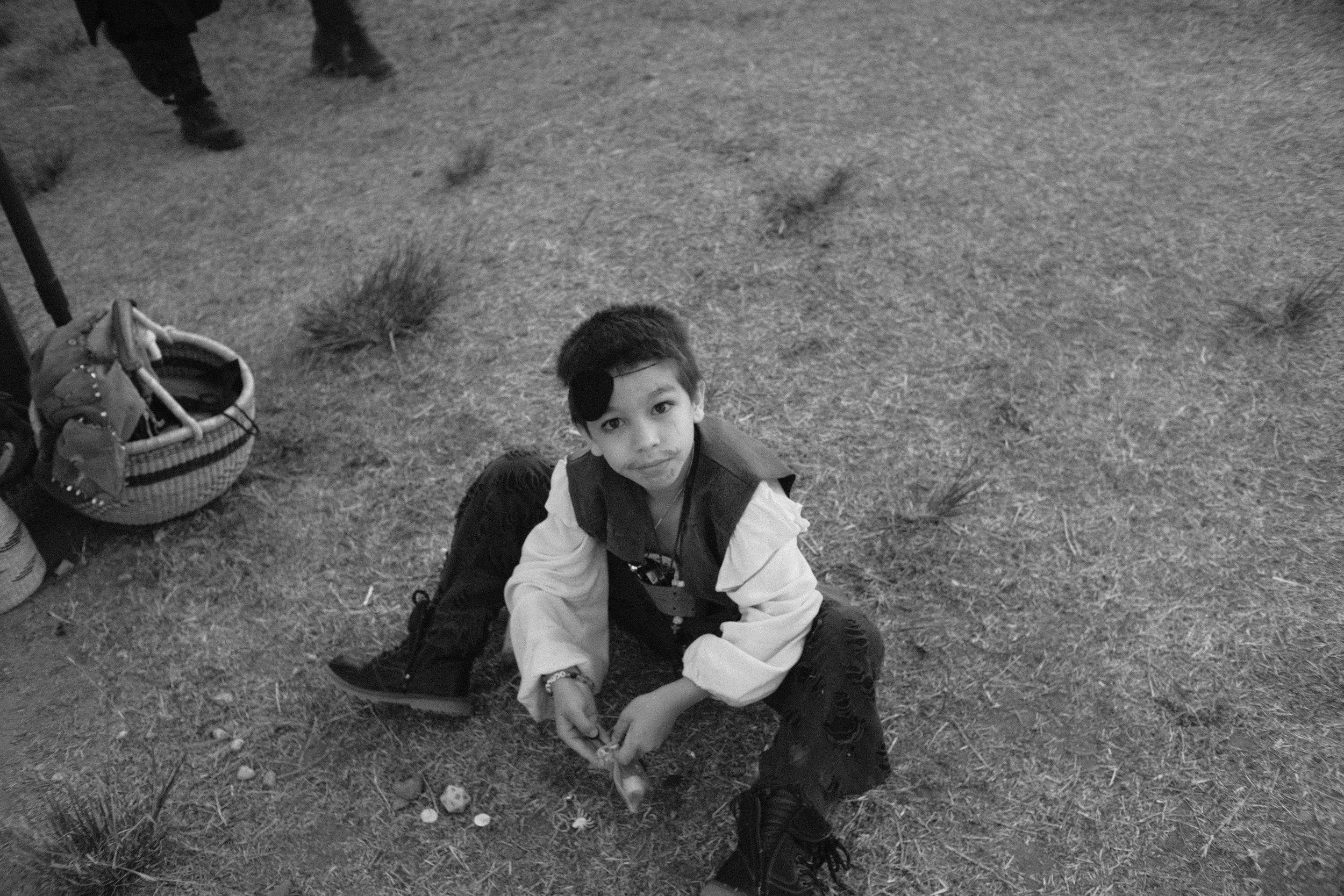 A young boy with a black eye sitting on the grass, looking up at the camera. There are some plants and backpacks nearby. The setting appears to be outdoors, possibly in a park or open field.