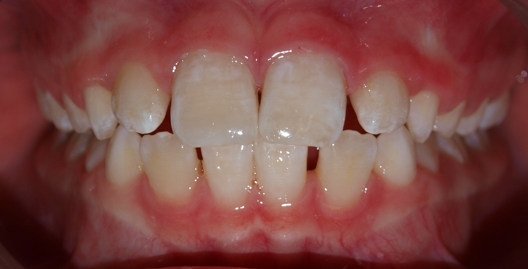 Dr. Lori Trost Cosmetic Dentist After 2