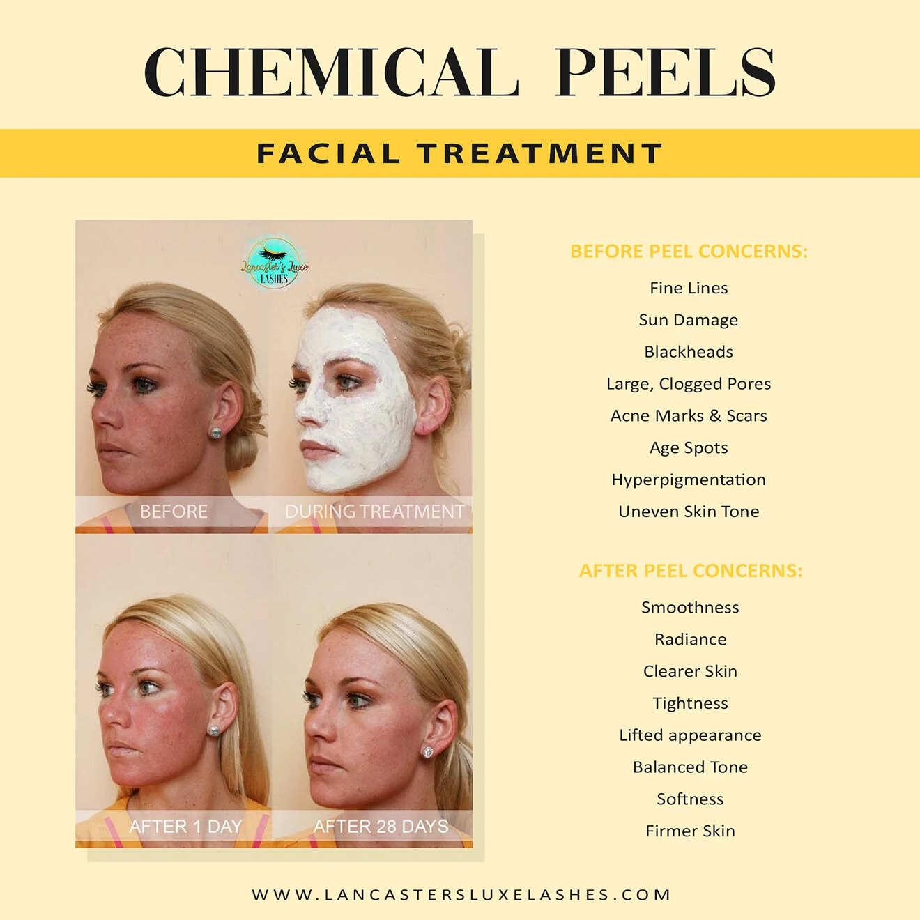 Chemical Peels — Lancaster’s Luxe Lashes