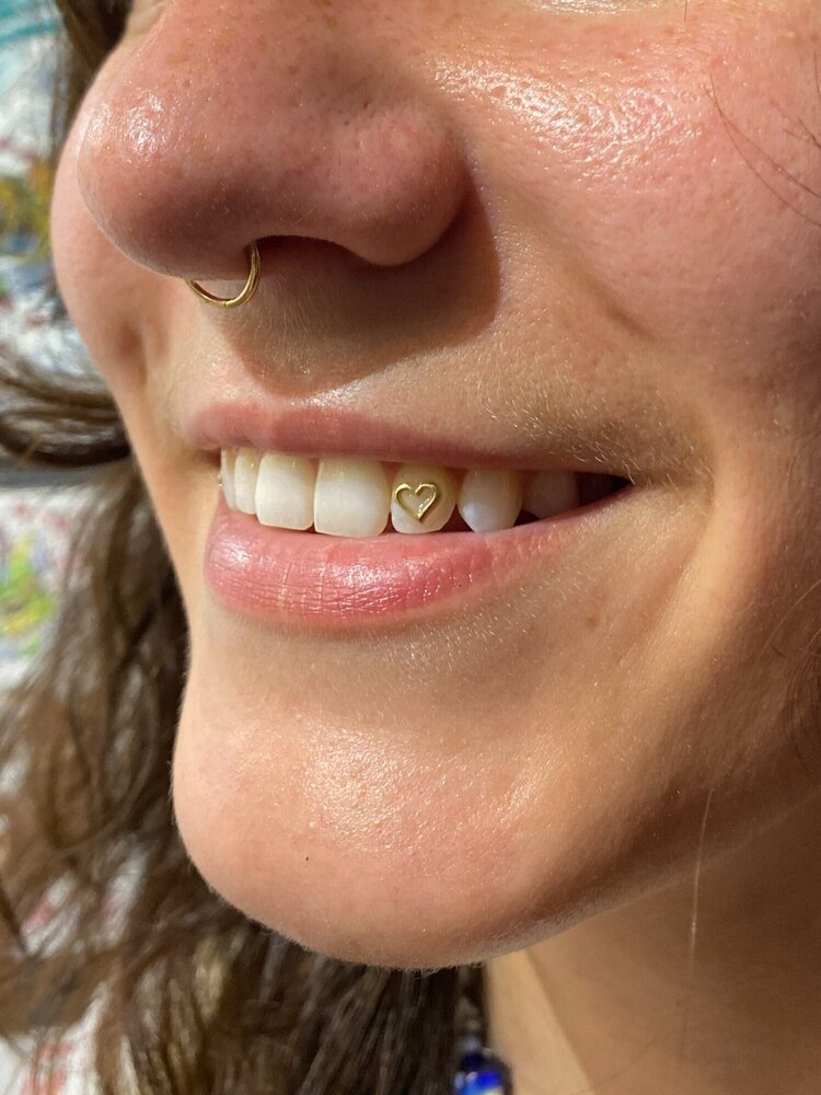 Tooth Gem