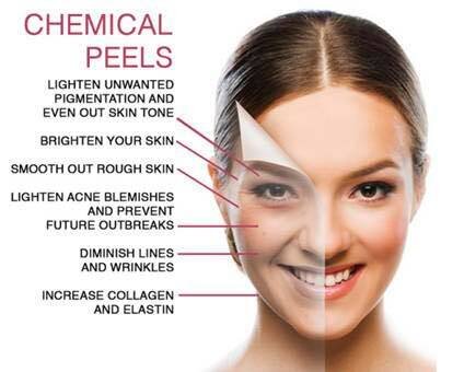 It&rsquo;s chemical Peel season now that we aren&rsquo;t in the sun.  Schedule your first facial and we can discuss working on your skin care goals. Jaime specializes in targeted advanced repair of your skin. 

#lashgoals #waxingtime #Estheticianslov