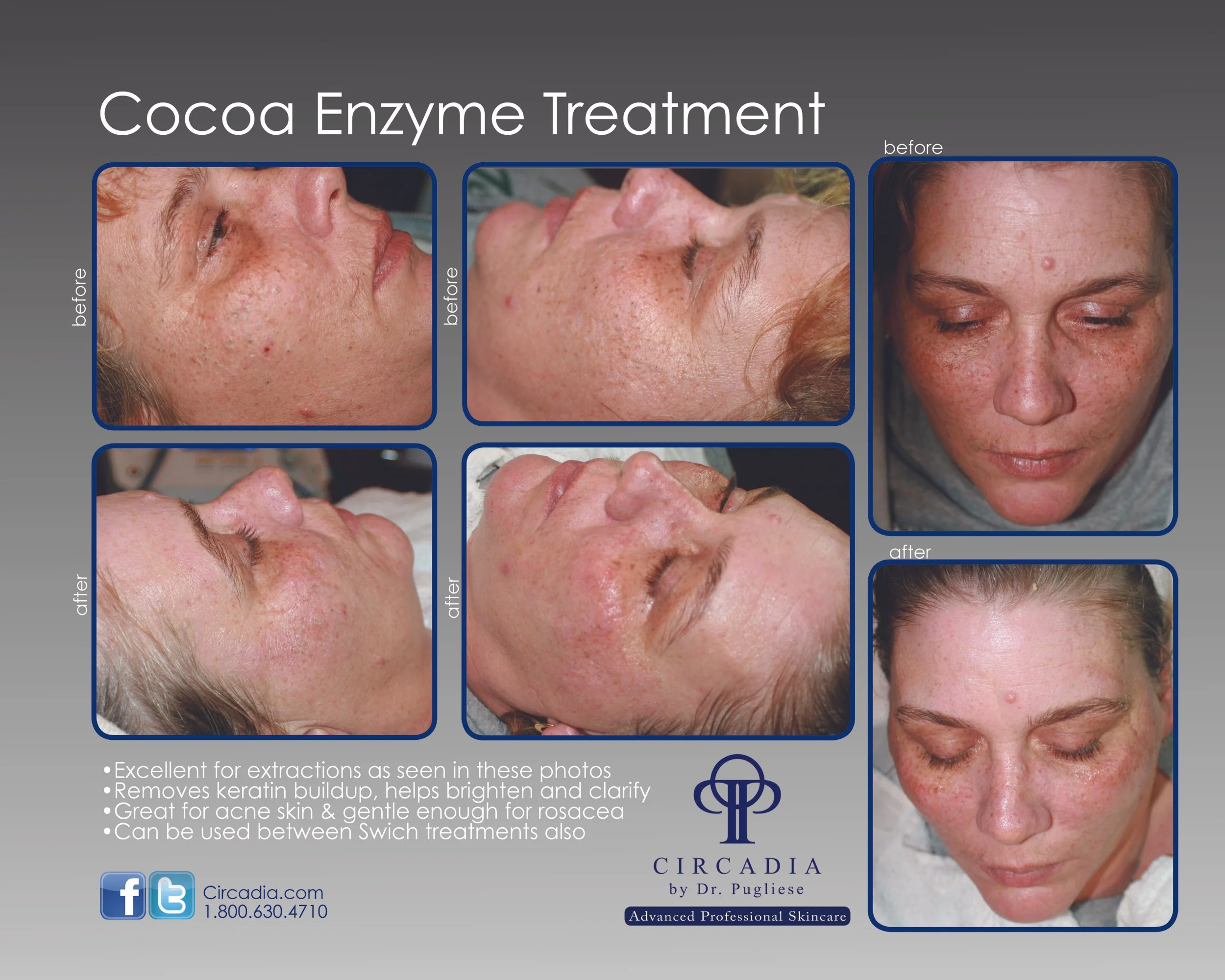 THE SCIENCE BEHIND ENZYME THERAPY FACIALS
