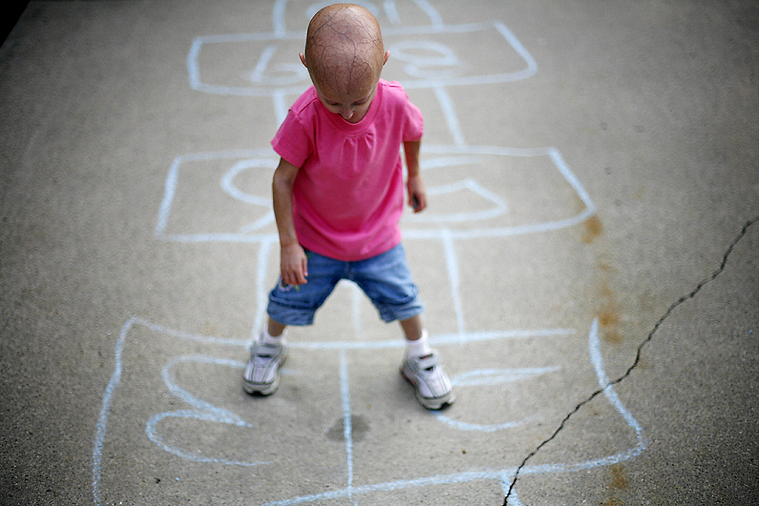 Lindsay Ratcliffe, 4, of Flat Rock, plays hopscotch in her front driveway, while her parents, Kristy and Joe Ratcliffe, look on, Thursday, July 17, 2008. Ratcliffe was diagnosed with Progeria when she was 5 five months old, and is a disease that age