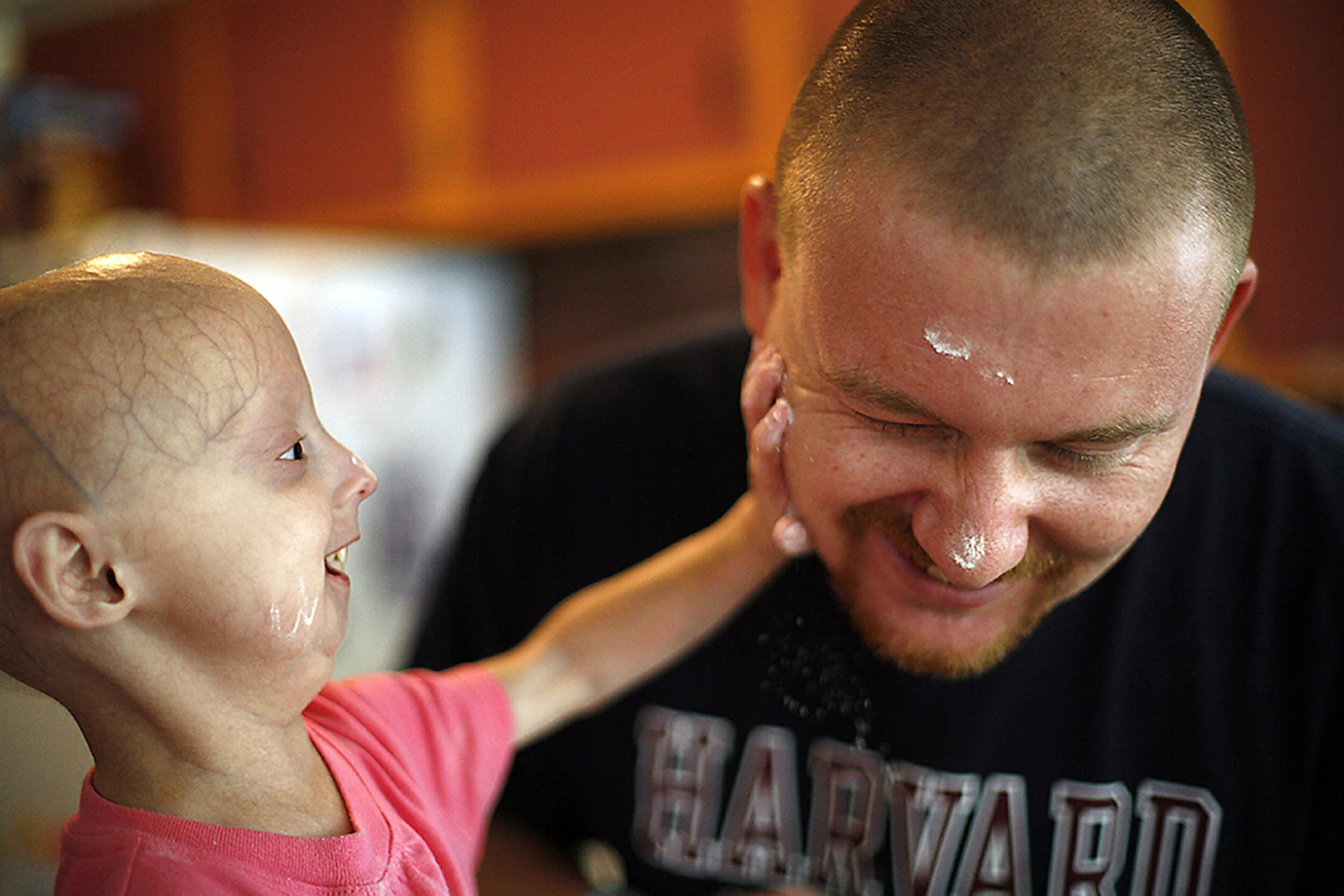  FOR TWIST0803_lindsayLindsay Ratcliffe CQkpm, 4, of Flat Rock,  puts flour on her dad, Joe Ratcliffe's CQkpm, 29, of Flat Rock, face while making chocolate chip cookies, Lindsay's favorite, at their home, July 2008. Lindsay was diagnosed with Proger