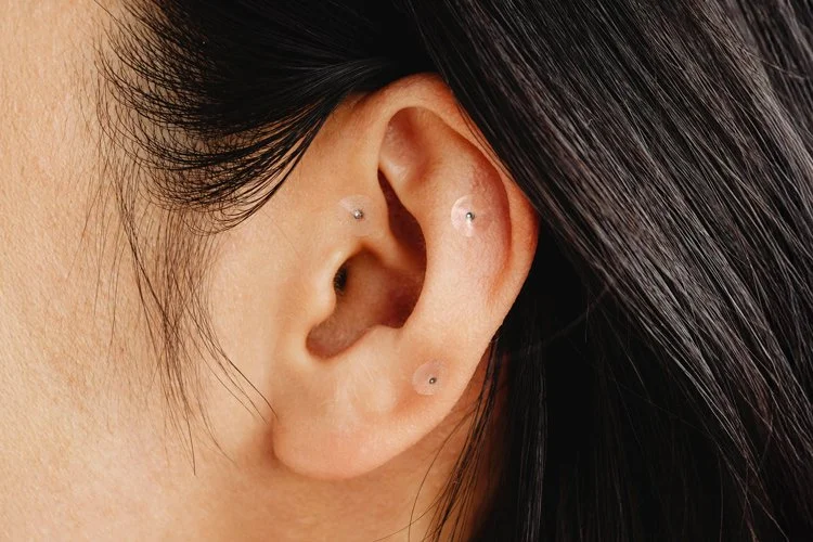 Closeup of a woman’s ear with three ear seeds placed on acupressure points