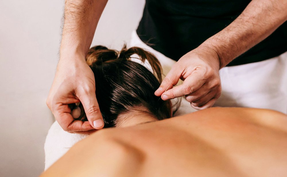 Acupuncturist placing needles into female patient’s neck