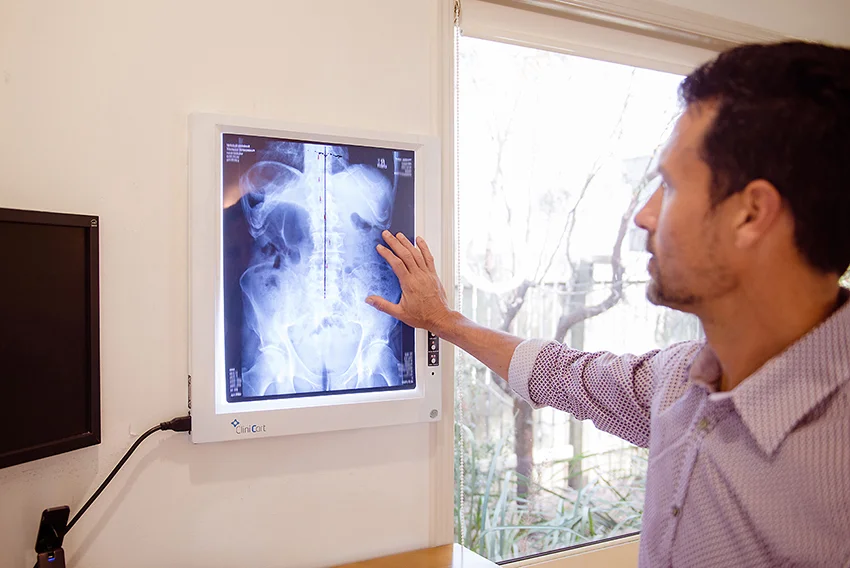 Spinal Assessment Family Chiropractic Bundaberg.jpg