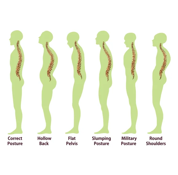 Advanced Bio-structural Correction Technique Chiropractic Bundaberg.jpg