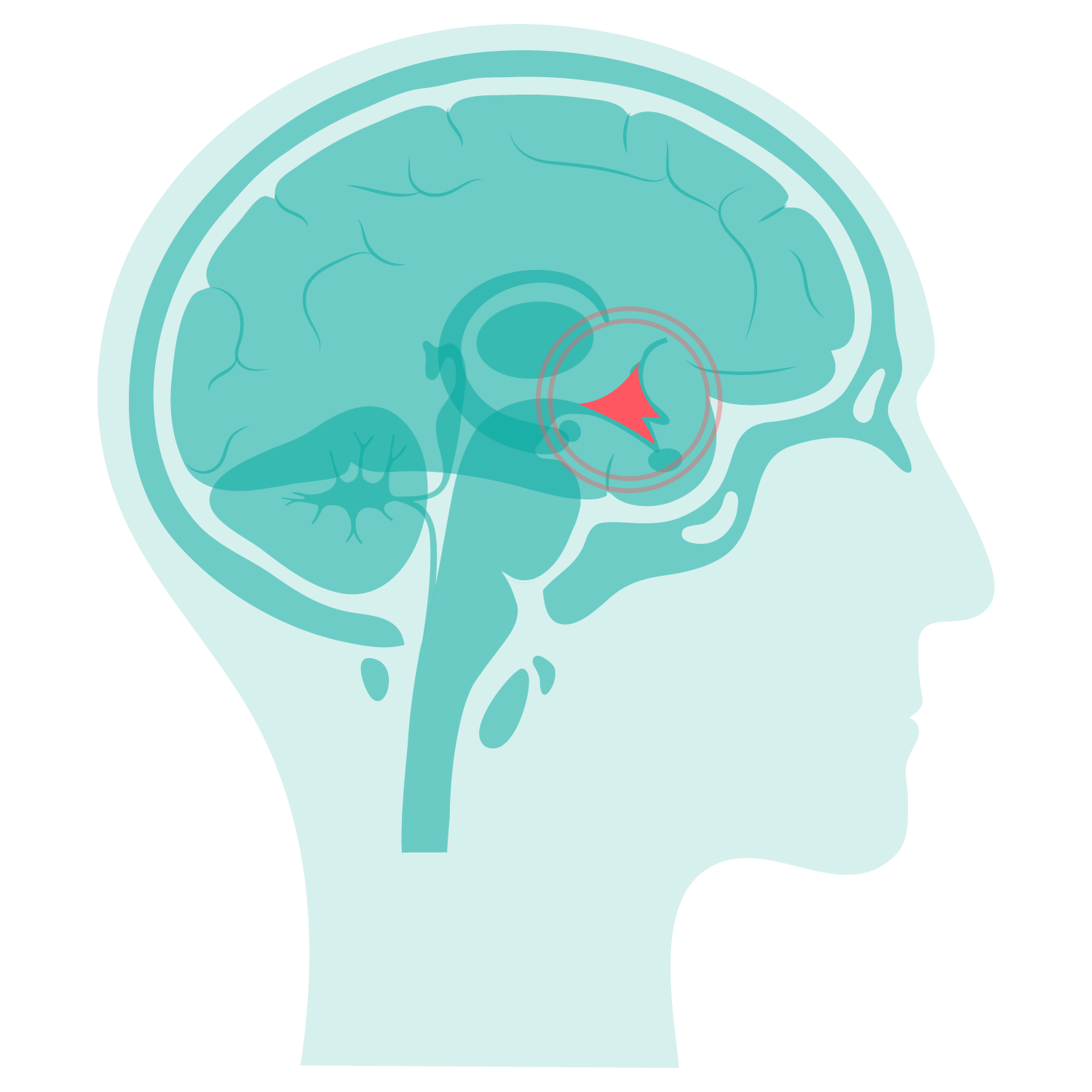 What is Hypothalamic Reset Technique (HRT)?
