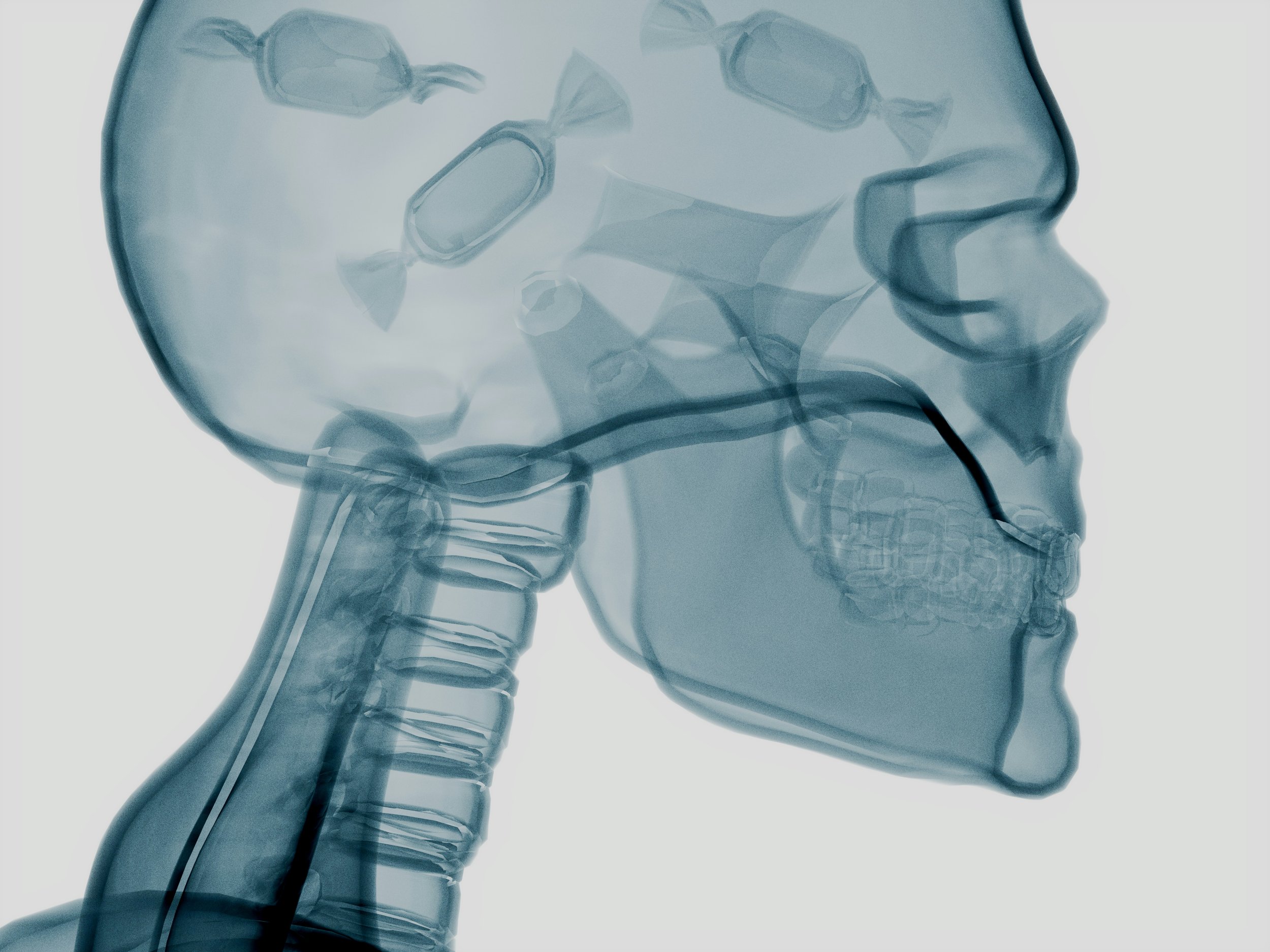 “Healthwashing” &amp; How The Big Food Industry Hijacks Your Brain