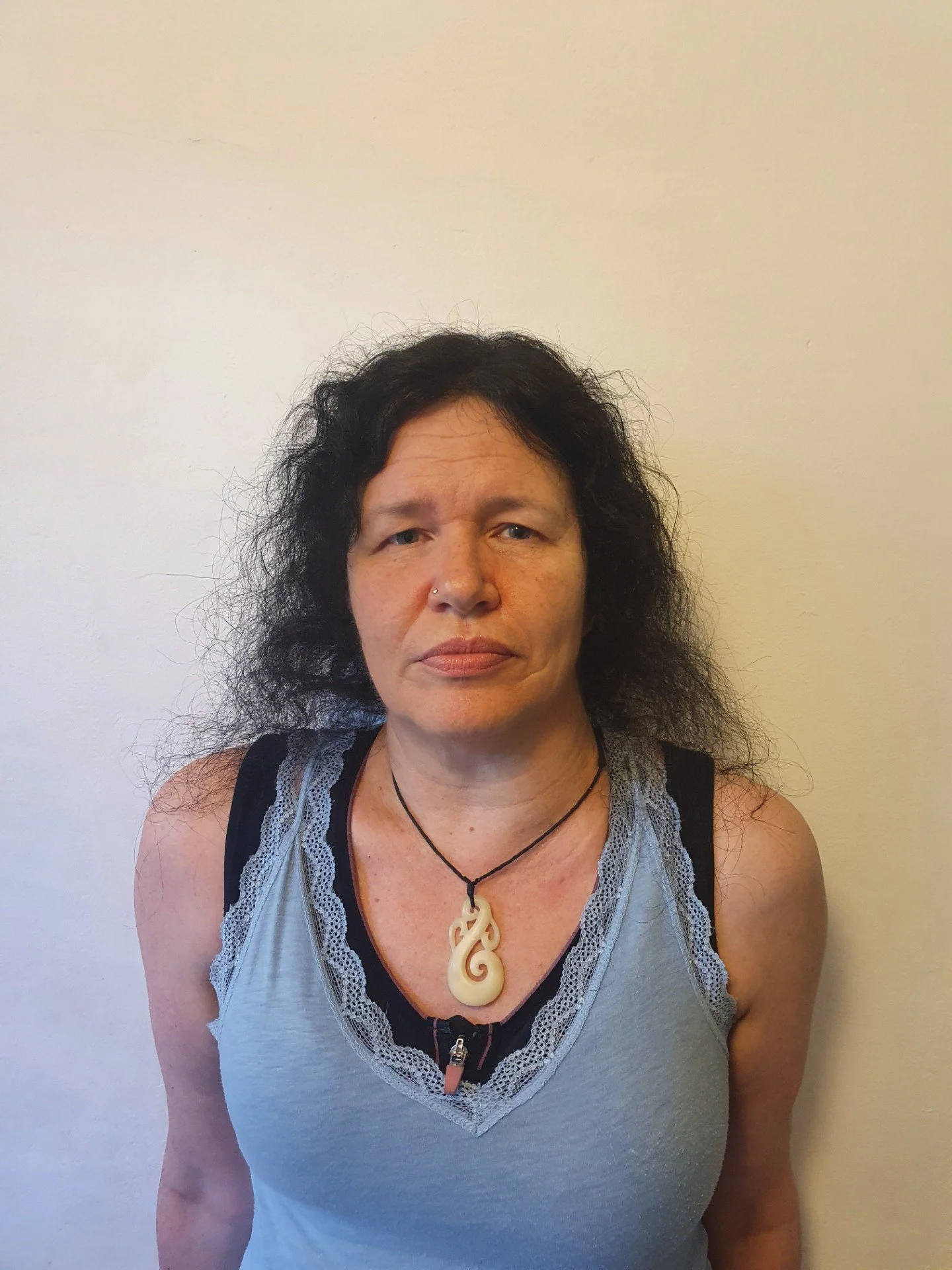  Following completion of chemotherapy 2020&nbsp; and scalp cooling - this is when my hair loss started to become more noticeable to me 
