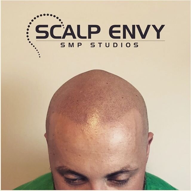 We&rsquo;re still available for consultations!! Contact us to find out how you can still receive your consult while practicing social distancing!

Scalp Envy SMP Studios
Whitby, On
905-903-6168
@bodyblisswhitby 
www.facebook.com/scalpenvysmp
www.scal