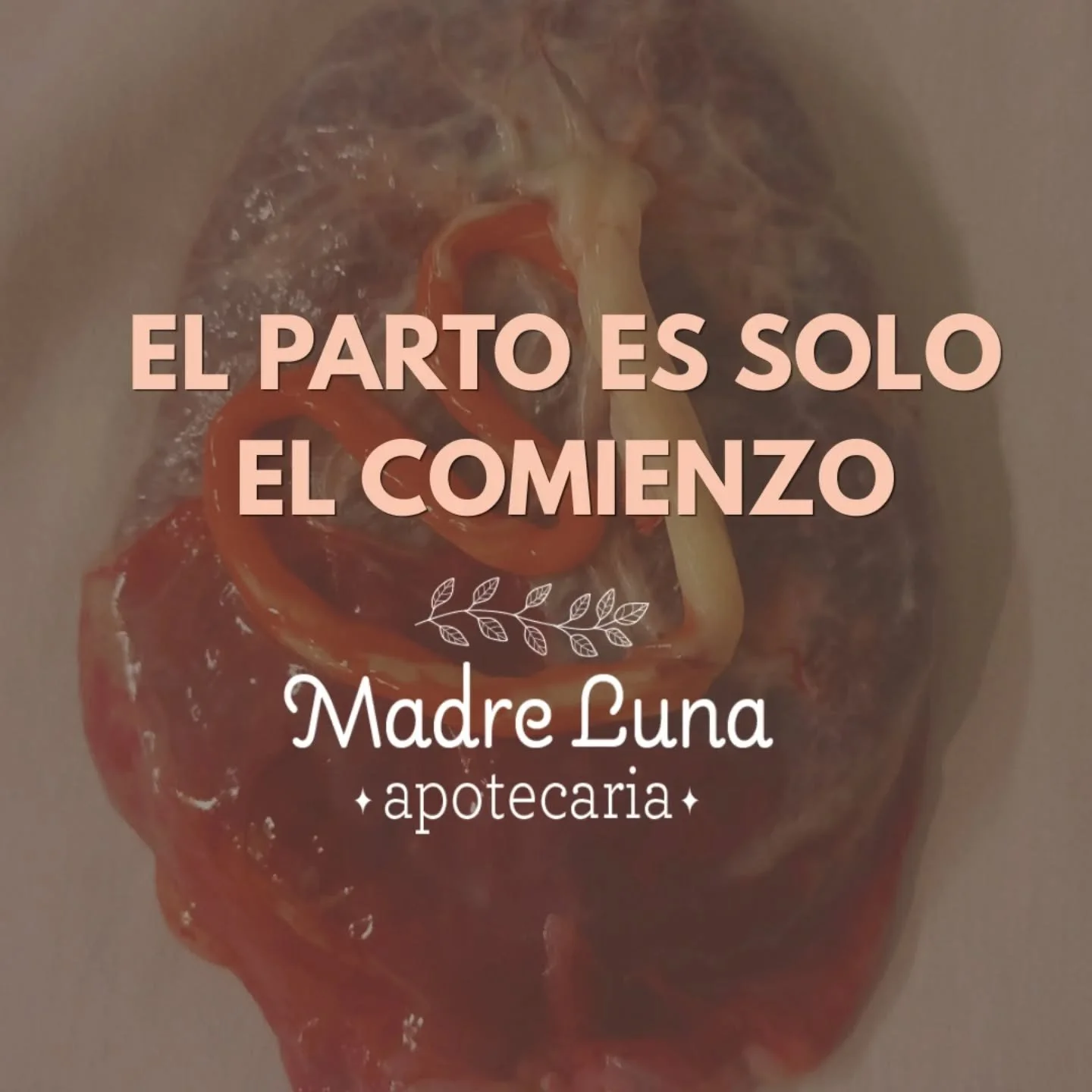 *El nacimiento no termina en el parto.* 🌿El posparto tambi&eacute;n merece cuidado, respeto y acompa&ntilde;amiento.
.
. Una madre sostenida emocionalmente puede vivir su maternidad con m&aacute;s calma, confianza y bienestar.
.
. Como doula, acompa