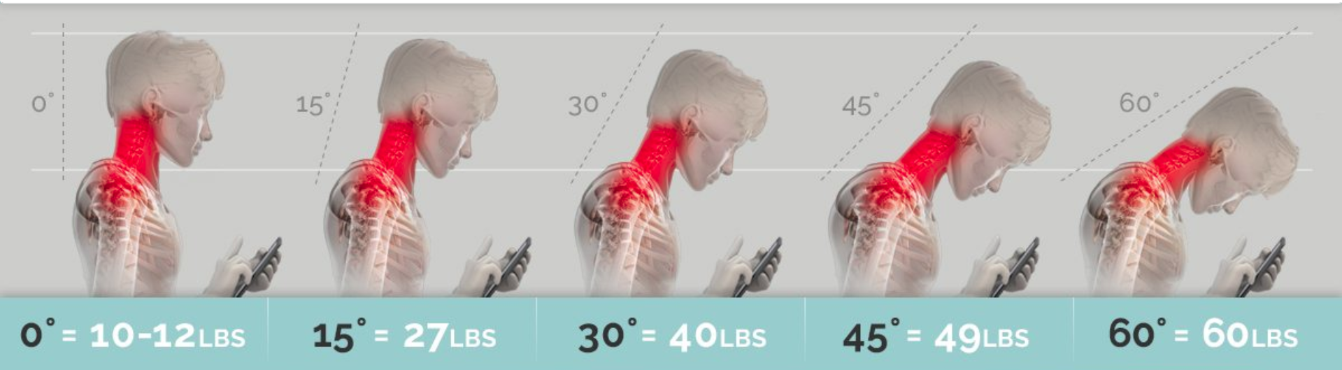 A Massage Therapists Take on Tech Neck — Midvalley Massage and Hypnotherapy  trauma/anxiety support