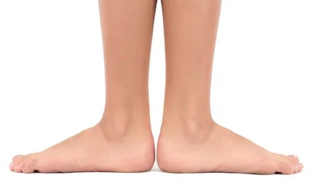flat feet.jpg