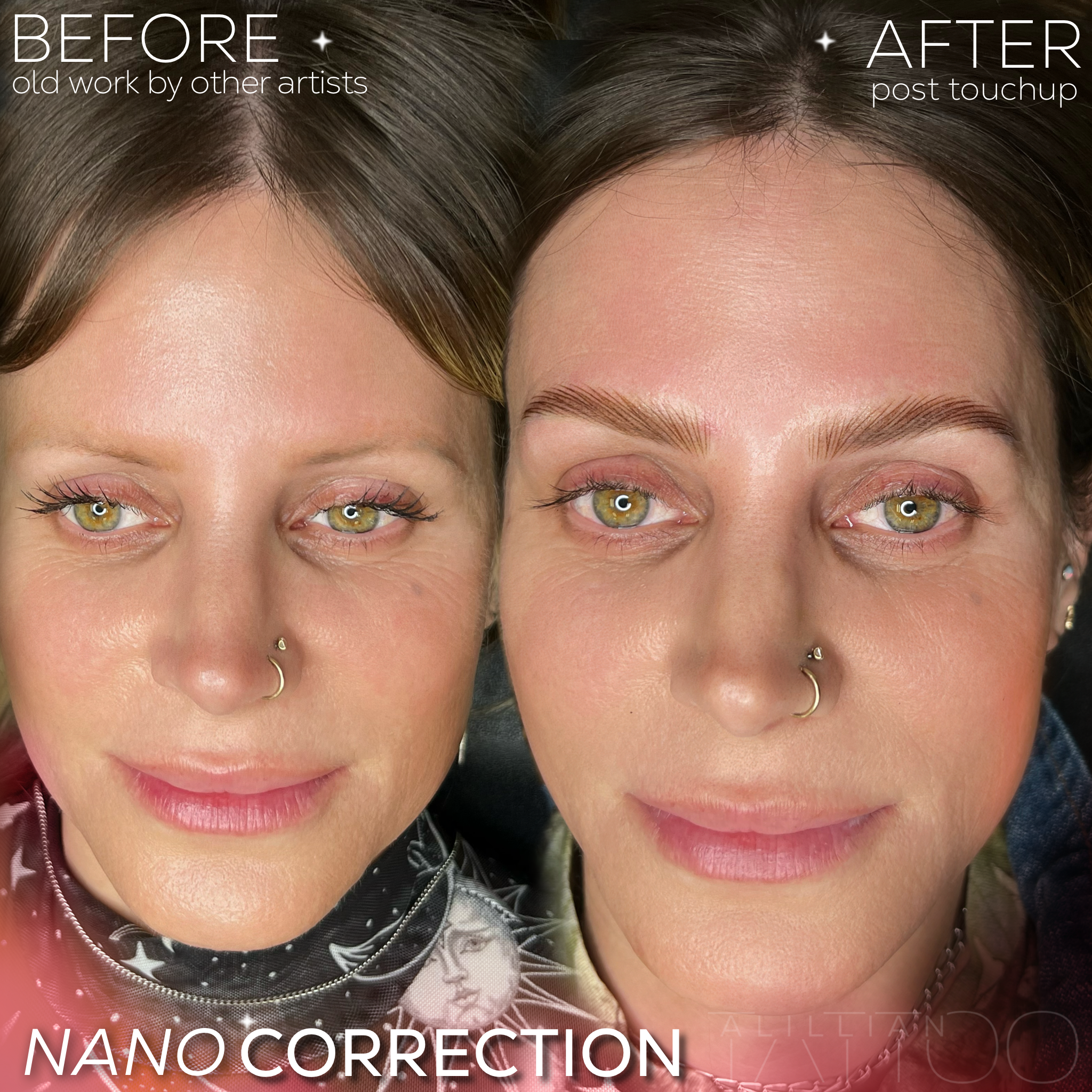 Nano brow correction after laser removal of old microblading